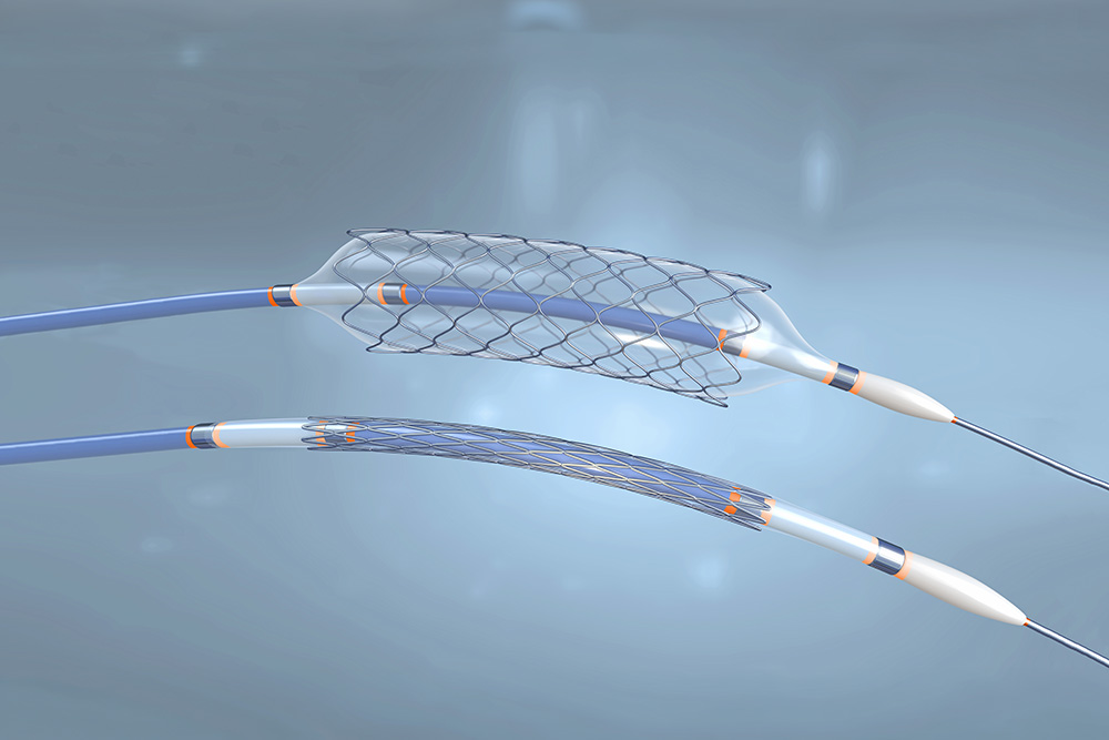 Colles pour cathéters